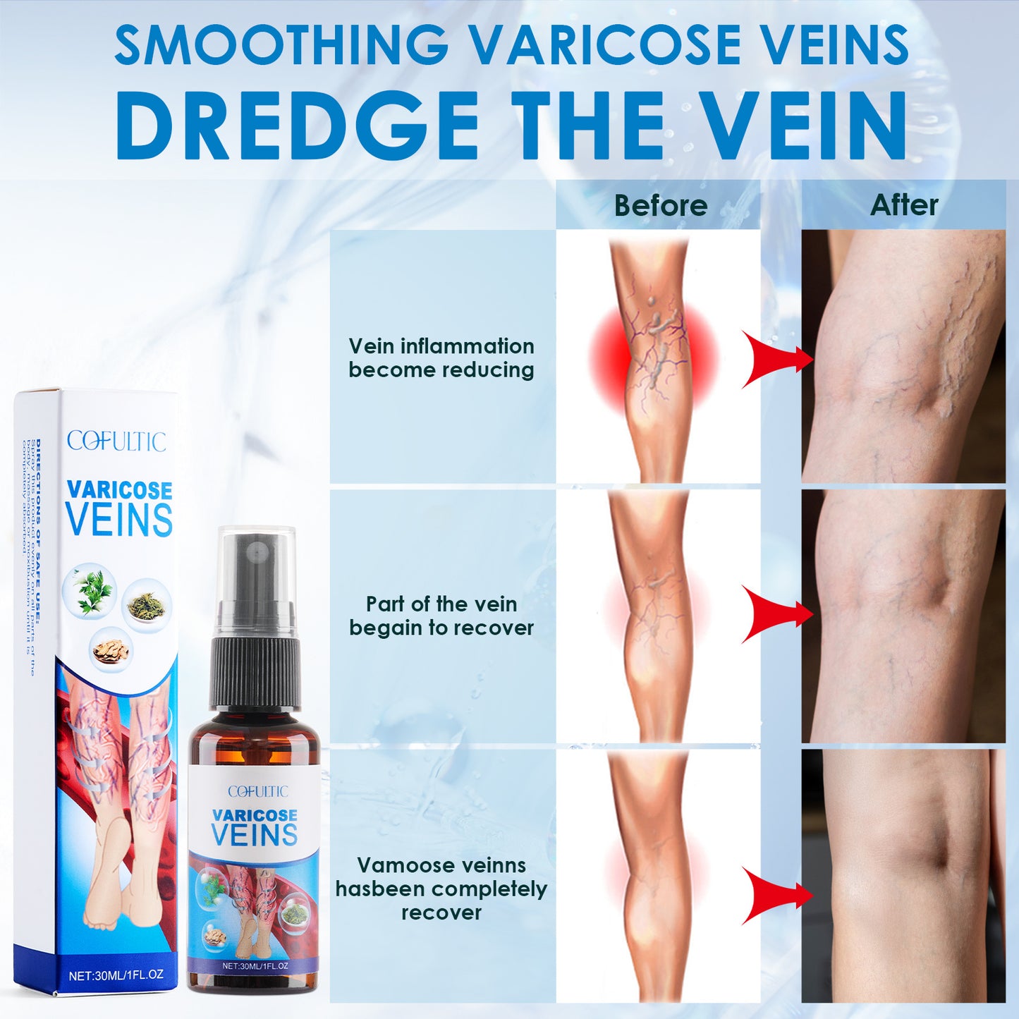 Varicose Vein Spray 30ml - Multi-Purpose Care for Knees and Legs