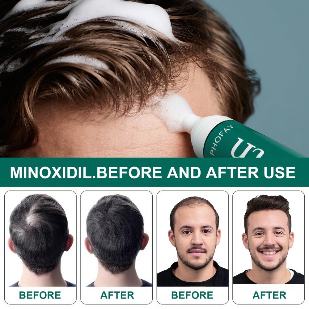 CH004 Mousse Anti - Chute de Cheveux au Minoxidil - Allomarc.com